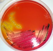 Salmonella enterica sv. Senftenberg W775 auf XLD-Agar