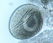 Ichthyophthirius multifiliis