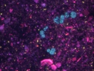 Fluoreszenzmikroskopische Aufnahme von Methanosarcinen (türkis) und Bakterien (gelb)