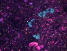 Fluoreszenzmikroskopische Aufnahme von Methanosarcinen (türkis) und Bakterien (gelb)