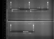 Virusnachweis durch Auftrennung der RT-PCR-Produkte auf einem AgaroseelektrophoresegelIPS 2c_Elektrophoresegel_PCR