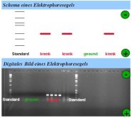 Das Bild zeigt schematische Darstellung der aufgetrennten PCR-Produkte nach der Elektrophorese; unten: digitale Fotografie eines Elektrophoresegels