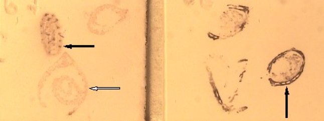 Gewebeabdrücke von virusbefallenen Gerstenhalmen nach dem Tissue Print Immunoassay (TPIA).  Schwarze Pfeile: infizierte Halme bzw. Stellen, an denen sich Viren häufen;  weißer Pfeil: virusfreier Halm