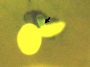 Interaktion einer Mehltauspore (gelb) mit ausgebildetem Haustorium (Pfeil) mit einer transformierten (blaugefärbten) Hopfen-Epidermiszelle