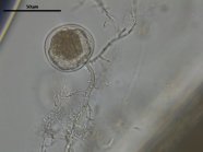 Anaerobe Pilzstruktur (Zoosporangium und Rhizoid)