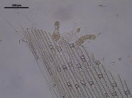 Mikroskopische Aufnahme anaerober Pilze im flüssigen Kulturmedium Weisenstroh