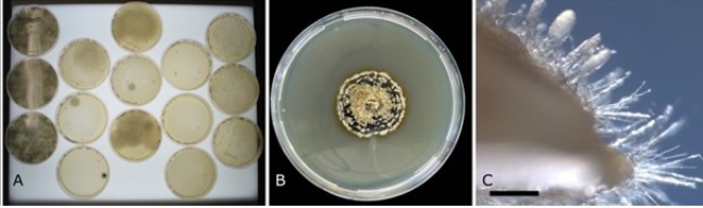 Pilzwachstum auf Ausstrich-Platten und in der mikroskopischen Vergrößerung